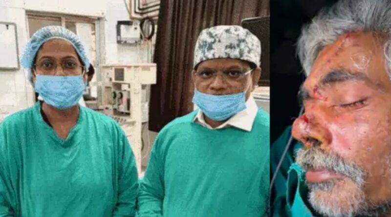 भागलपुर में सर्जरी कर कटी नाक को पहले जैसा किया:सड़क हादसे में नाक हो गया था डैमेज