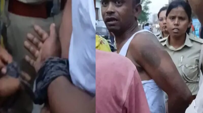 हॉस्पिटल से मोबाइल चुराया:समस्तीपुर में बदमाश के लोगों ने बांधे हाथ, शहर में घुमाया