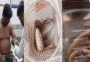 कोबरा लेकर समस्तीपुर हॉस्पिटल पहुंचा युवक, बोला-डॉक्टर साहब, बचा लीजिए