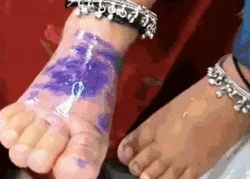वंदेभारत में गर्म पानी से 1 साल का बच्चा झुलसा:डिस्पोजेबल ग्लास में अटेंडेंट ने दिया पानी, प्लास्टिक फटते ही..